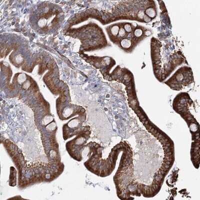 Immunohistochemistry-Paraffin: ZCCHC9 Antibody [NBP1-84102]