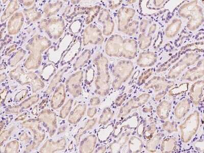 Immunohistochemistry-Paraffin: ZCCHC9 Antibody [NBP2-97817]