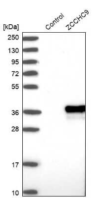 Western Blot: ZCCHC9 Antibody [NBP1-84102]