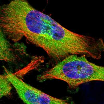 Immunocytochemistry/ Immunofluorescence: ZCCHV Antibody [NBP1-92607]