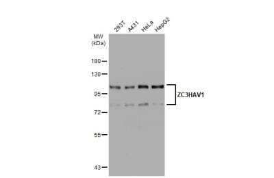 Western Blot: ZCCHV Antibody [NBP2-20940]