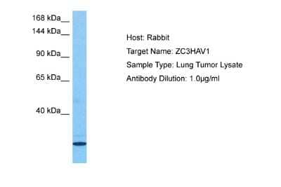 Western Blot: ZCCHV Antibody [NBP2-88613]