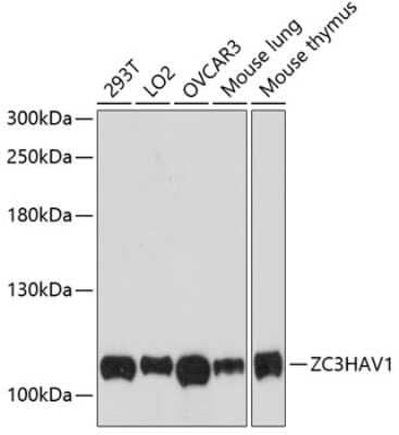 Western Blot: ZCCHV AntibodyAzide and BSA Free [NBP2-93113]