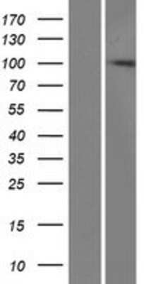 Western Blot: ZCCHV Overexpression Lysate [NBP2-06692]