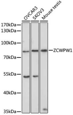 Western Blot: ZCPW1 AntibodyBSA Free [NBP2-93334]