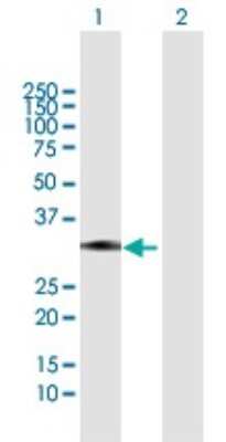 Western Blot: ZCRB1 Antibody [H00085437-B01P]