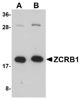 Western Blot: ZCRB1 AntibodyBSA Free [NBP1-76319]