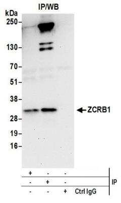 Western Blot: ZCRB1 Antibody [NBP2-37757]