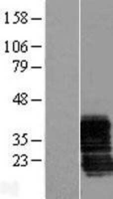 Western Blot: ZCRB1 Overexpression Lysate [NBL1-17997]