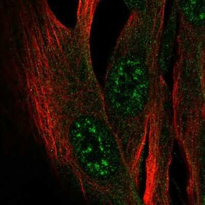 Immunocytochemistry/ Immunofluorescence: ZCWPW2 Antibody [NBP2-58428]