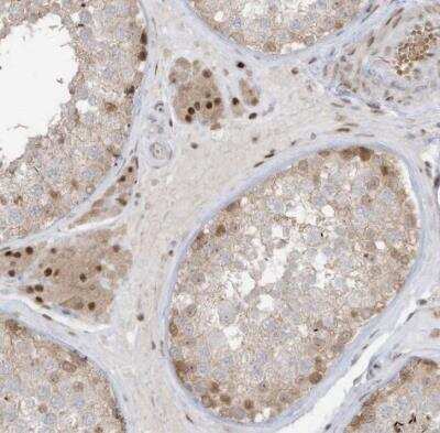 Immunohistochemistry-Paraffin: ZCWPW2 Antibody [NBP1-80606]