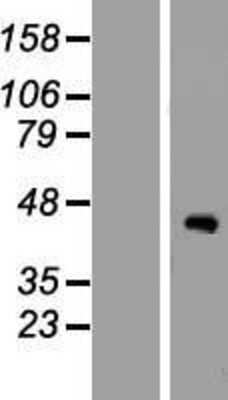 Western Blot: ZCWPW2 Overexpression Lysate [NBP2-08511]