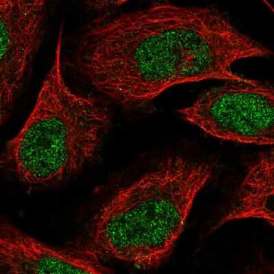 Immunocytochemistry/ Immunofluorescence: ZDBF2 Antibody [NBP2-55643]