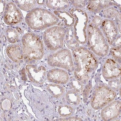 Immunohistochemistry-Paraffin: ZDHHC1 Antibody [NBP2-13539]