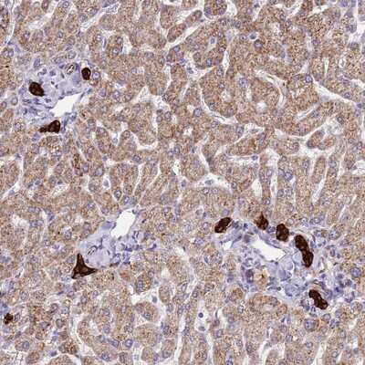 Immunohistochemistry-Paraffin: ZDHHC1 Antibody [NBP2-13540]