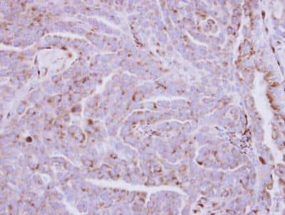 Immunohistochemistry-Paraffin: ZDHHC11 Antibody [NBP2-15166]