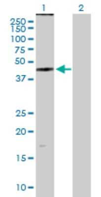 Western Blot: ZDHHC11 Antibody [H00079844-B01P]