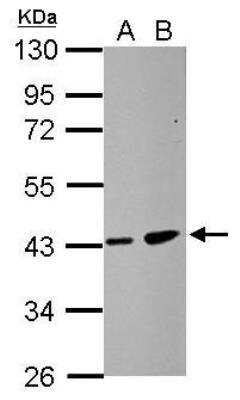 Western Blot: ZDHHC11 Antibody [NBP2-15166]