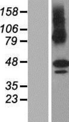 Western Blot: ZDHHC11 Overexpression Lysate [NBP2-06281]