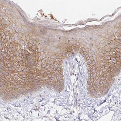 Immunohistochemistry-Paraffin: ZDHHC11/ZDHHC11B Antibody [NBP2-34089]