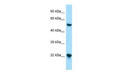 Western Blot: ZDHHC12 Antibody [NBP2-83794]