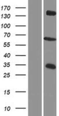 Western Blot: ZDHHC12 Overexpression Lysate [NBP2-05937]