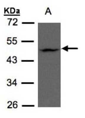 Western Blot: ZDHHC13 Antibody [NBP1-31024]