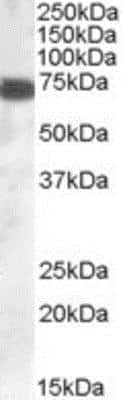 Western Blot: ZDHHC13 Antibody [NBP1-51920]