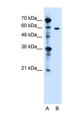 Western Blot: ZDHHC13 Antibody [NBP1-59026]