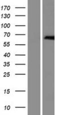 Western Blot: ZDHHC13 Overexpression Lysate [NBP2-09892]