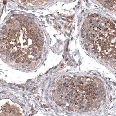 Immunohistochemistry-Paraffin: ZDHHC14 Antibody [NBP1-92608]