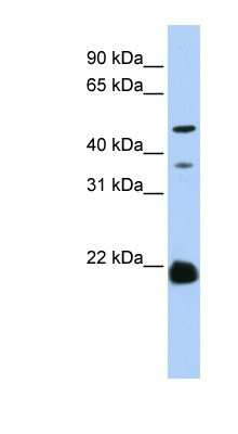 Western Blot: ZDHHC14 Antibody [NBP1-60110]