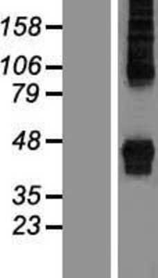 Western Blot: ZDHHC14 Overexpression Lysate [NBP2-05224]