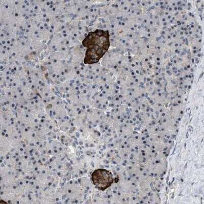 Immunohistochemistry-Paraffin: ZDHHC15 Antibody [NBP1-82014]