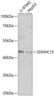 Western Blot: ZDHHC15 AntibodyAzide and BSA Free [NBP2-94338]