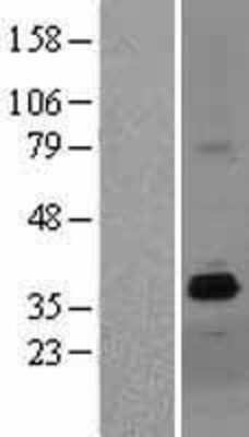 Western Blot: ZDHHC15 Overexpression Lysate [NBL1-18000]