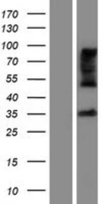 Western Blot: ZDHHC15 Overexpression Lysate [NBP2-10143]