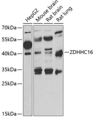 Western Blot: ZDHHC16 AntibodyBSA Free [NBP2-93030]