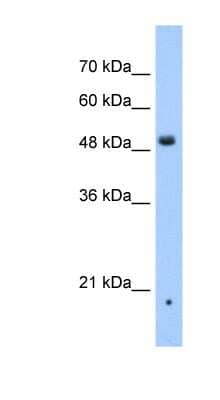 Western Blot: ZDHHC16 Antibody [NBP1-59446]