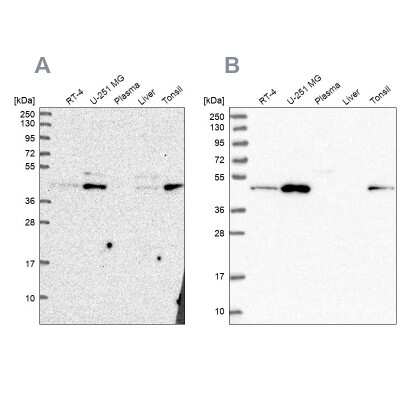 Western Blot: ZDHHC16 Antibody [NBP2-55212]