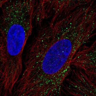 Immunocytochemistry/ Immunofluorescence: ZDHHC17 Antibody [NBP2-68744]