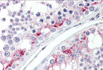 Immunohistochemistry-Paraffin: ZDHHC17 Antibody [NB100-1505]