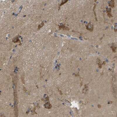 Immunohistochemistry-Paraffin: ZDHHC17 Antibody [NBP1-81748]