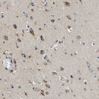 Immunohistochemistry-Paraffin: ZDHHC17 Antibody [NBP1-81748]