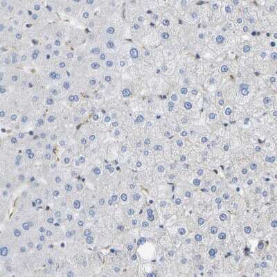 Immunohistochemistry-Paraffin: ZDHHC17 Antibody [NBP1-81748]