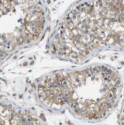 Immunohistochemistry-Paraffin: ZDHHC17 Antibody [NBP1-81748]