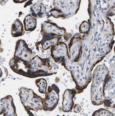 Immunohistochemistry-Paraffin: ZDHHC17 Antibody [NBP1-81748]