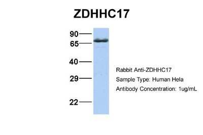 Western Blot: ZDHHC17 Antibody [NBP1-59039]