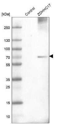 Western Blot: ZDHHC17 Antibody [NBP1-81748]