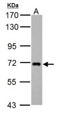 Western Blot: ZDHHC17 Antibody [NBP2-20941]